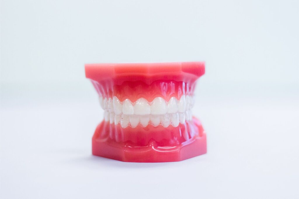 Orthodontics San Marino